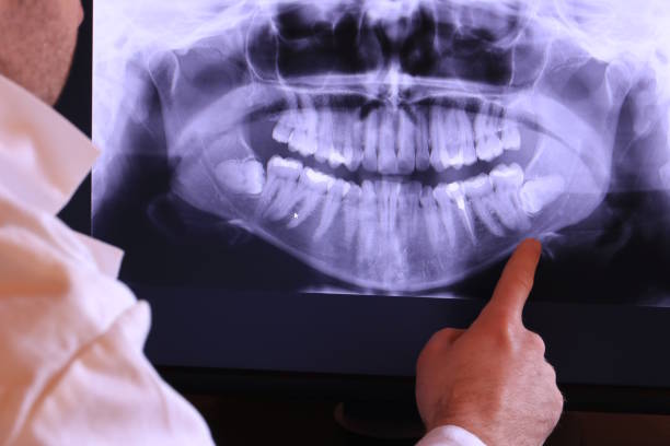 Best Pediatric Emergency Dentist in Ashland, VA