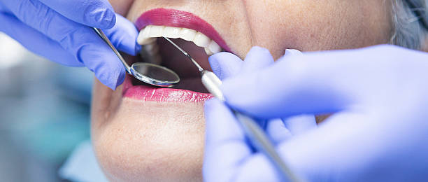 Best Walk-In Emergency Dentist in Ashland, VA